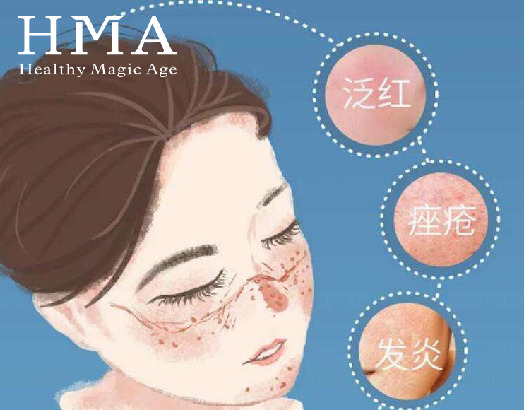 拯救敏感肌|变“口罩脸”怎么办？