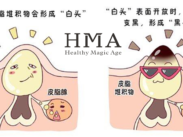毛孔粗大？痘印不消？怎么解决？